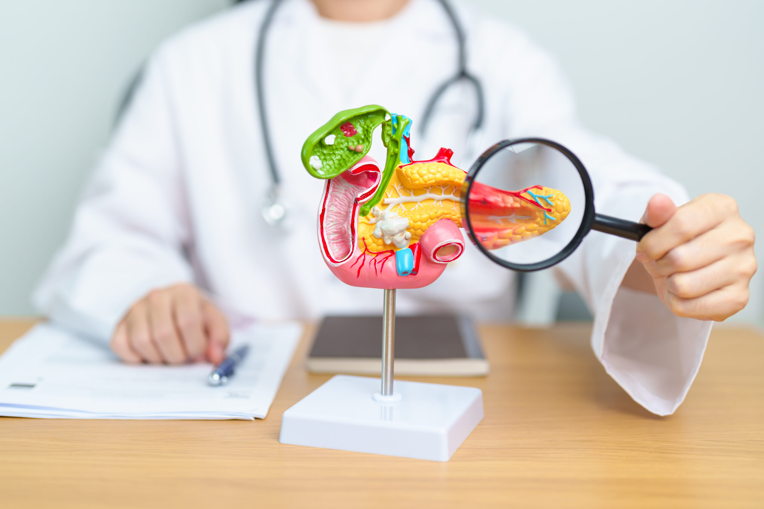 Doctor with human Pancreatitis anatomy model with Pancreas, Gallbladder, Bile Duct, Duodenum, Small intestine and magnifying glass. Pancreatic cancer, acute pancreatitis and Digestive system